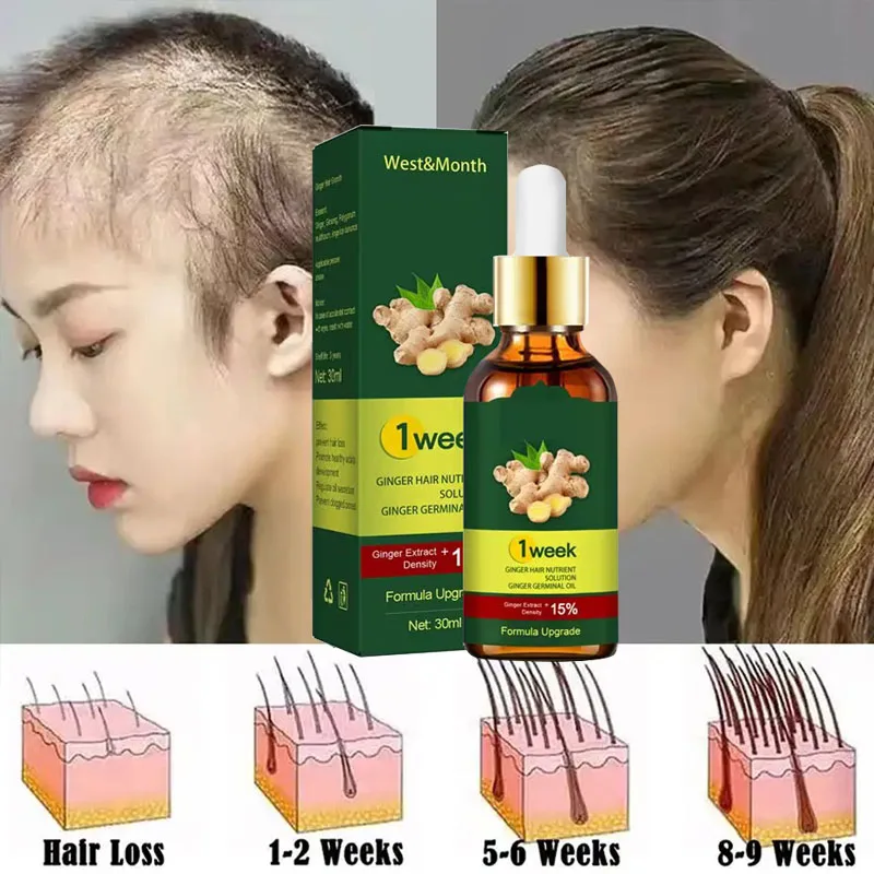 洗髪用エッセンシャルオイル,髪の成長製品,髪の強化,頭皮治療 - Licorice Root Sticks のレビューと価格